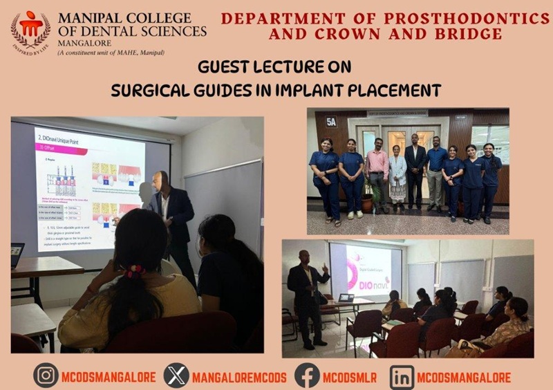 Surgical Guides in Implant Placem